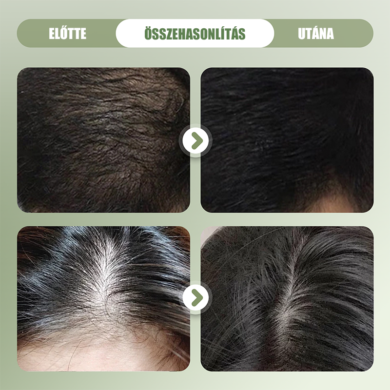 🌿 Naravni šampon v trdi obliki za krepitev las 🌱🥰-SL